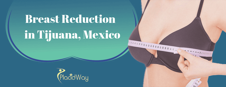 Breast Reduction in Tijuana Mexico